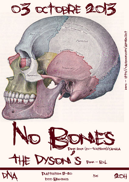 No Bones + The Dyson's au DNA le 03 octobre 2013 à Bruxelles (BE)