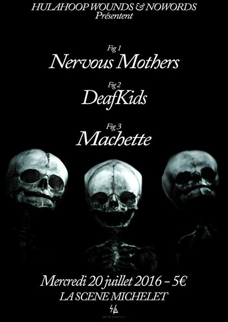DeafKids + Nervous Mothers + Machette à la Scène Michelet le 20 juillet 2016 à Nantes (44)